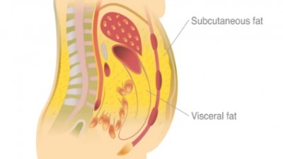 내장지방과 피하지방의 차이